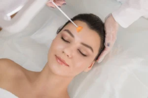 Chemical peels treatment in Boynton Beach, FL