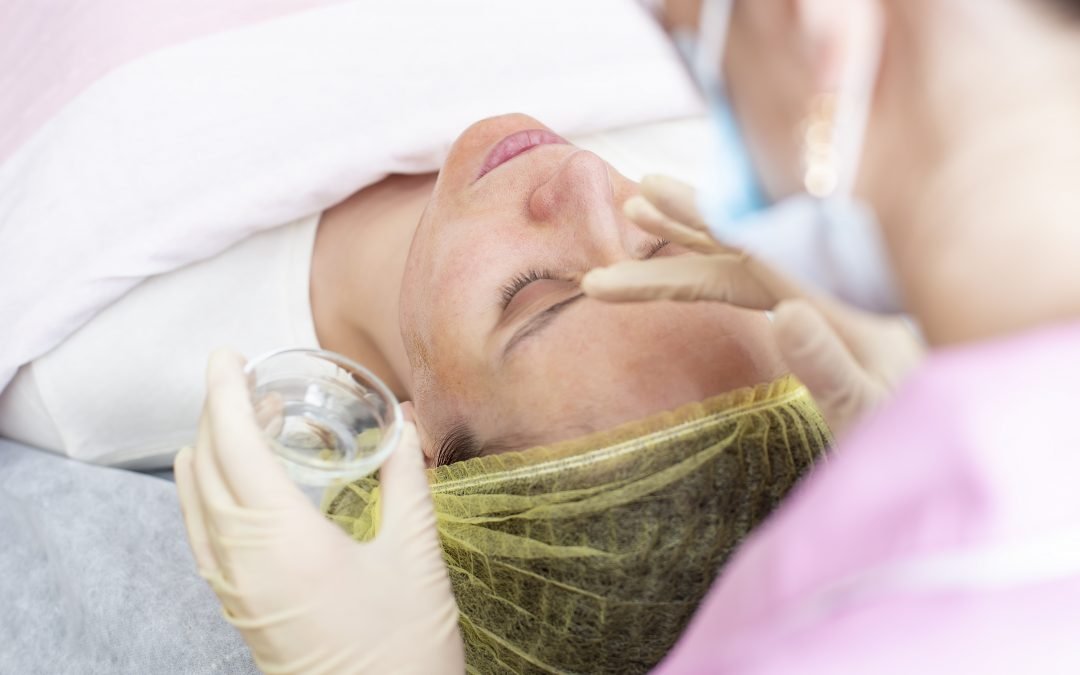 Improve Your Skin with a Chemical Peel
